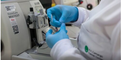 Publicada lei que amplia prevenção e controle do câncer no SUS