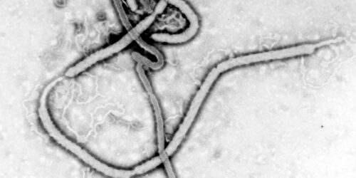 Casos de Ebola na África acendem alerta para risco de disseminação e OMS declara emergência internacional