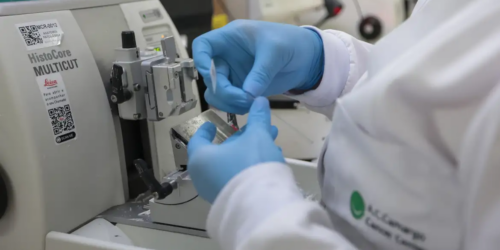 Nova terapia para pacientes com leucemia mieloide será ofertada pelo SUS