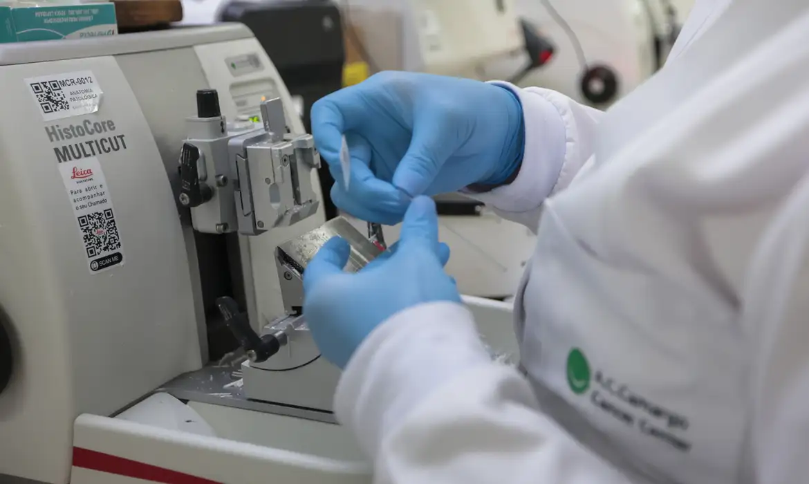Nova terapia para pacientes com leucemia mieloide será ofertada pelo SUS