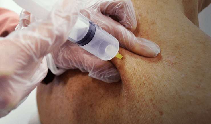 Ozonioterapia é nova área para farmacêutico e novo desafio para a fiscalização